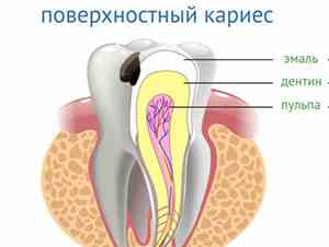 Акция на первичную консультацию стоматолога в Омске